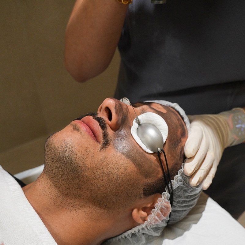 Spectra Carbon Laser